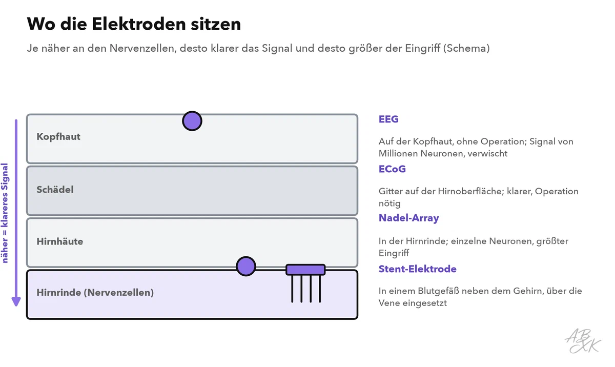 Querschnitt von der Kopfhaut bis zum Gehirn: EEG-Elektroden sitzen auf der Kopfhaut, ECoG-Gitter auf der Oberfläche des Gehirns, Nadel-Arrays in der Hirnrinde und Stent-Elektroden in einem Blutgefäß; je tiefer, desto klarer das Signal und desto größer der Eingriff